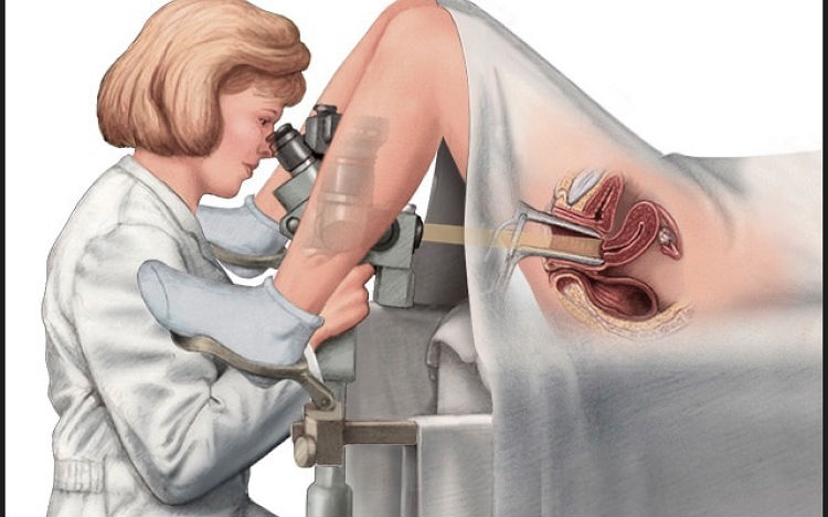A Colposcopy Is A Visual Examination Of The?