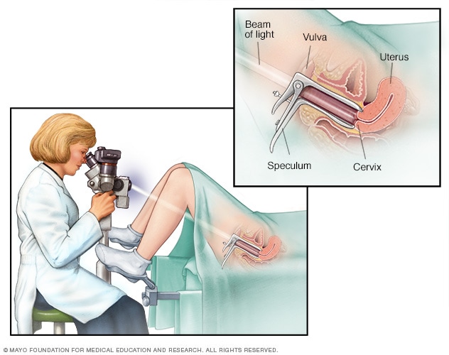 A Colposcopy Is A Visual Examination Of The:?